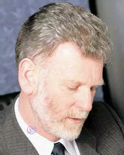 Oscar | Men's Hairpiece By Leading Man Toupee For Men